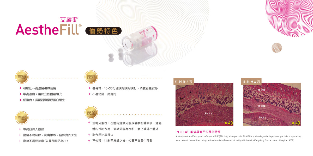優點